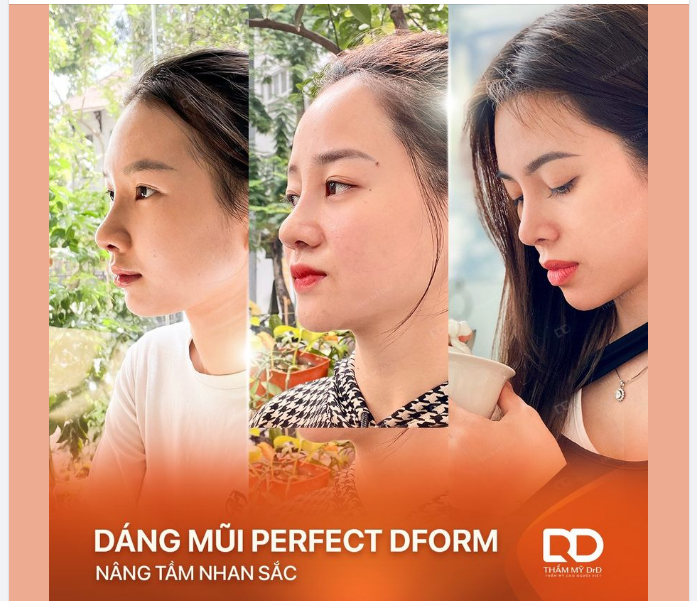 DÁNG MŨI PERFECT DFORM – NÂNG TẦM NHAN SẮC