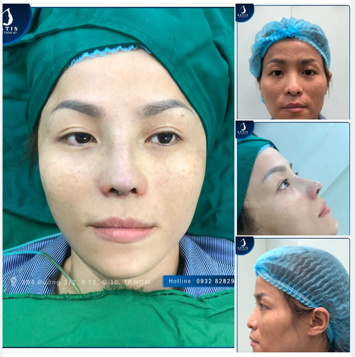 KẾT QUẢ SAU 90 PHÚT LÀM ĐẸP - NHAN SẮC THĂNG HẠNG