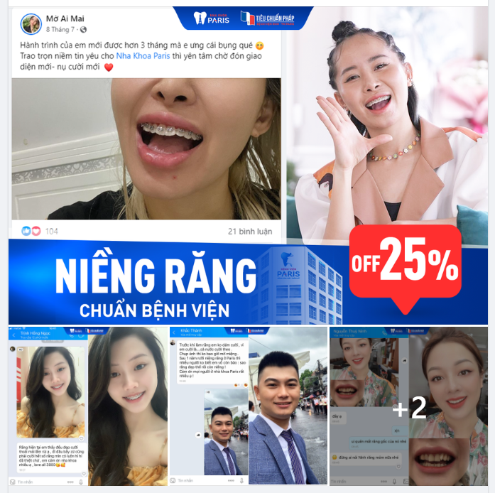 Hơn 25000 Case KH Niềng Răng Thành Công