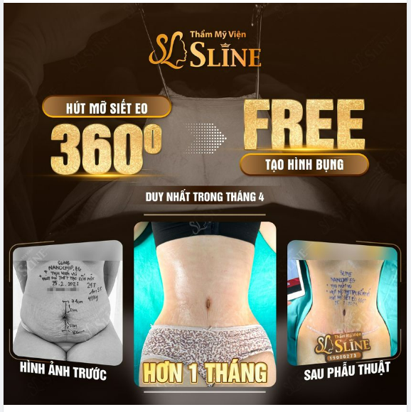 ❝ Nói là làm ❞ HÚT MỠ SIẾT EO 360° - FREE TẠO HÌNH BỤNG