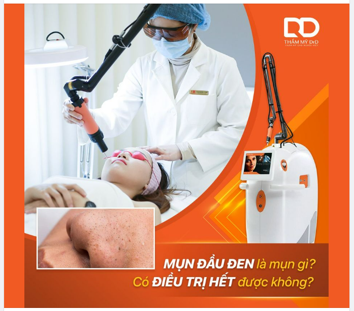MỤN ĐẦU ĐEN LÀ MỤN GÌ? CÓ ĐIỀU TRỊ HẾT ĐƯỢC KHÔNG?
