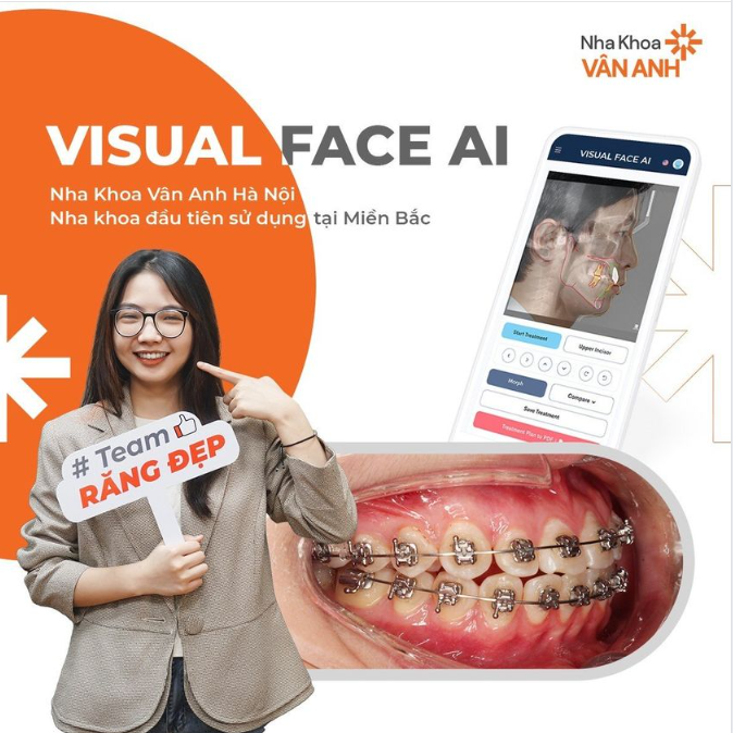 Nha Khoa đầu tiên tại miền Bắc ứng dụng VisualFaceAI