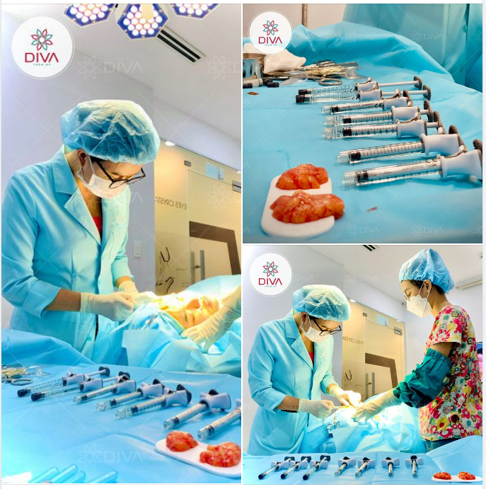 GIẢI PHÁP CẢI THIỆN GƯƠNG MẶT BỊ CHẢY XỆ LÀ GÌ?