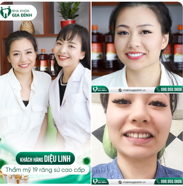 RĂNG ĐẸP NHƯ Ý - PHÚ QUÝ VỀ NHÀ