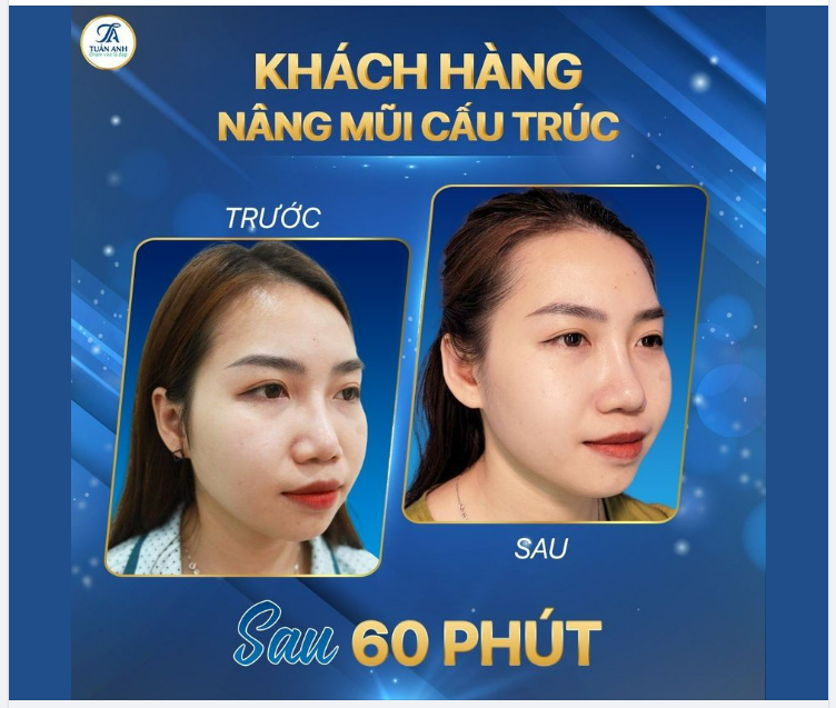 "Nhan sắc xinh đẹp hơn thì tự khắc mọi chuyện may mắn và hạnh phúc sẽ tới"