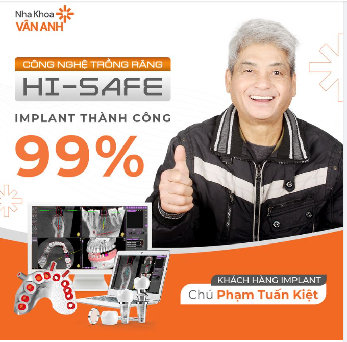 IMPLANT KHÔNG ĐAU THÀNH CÔNG 99%