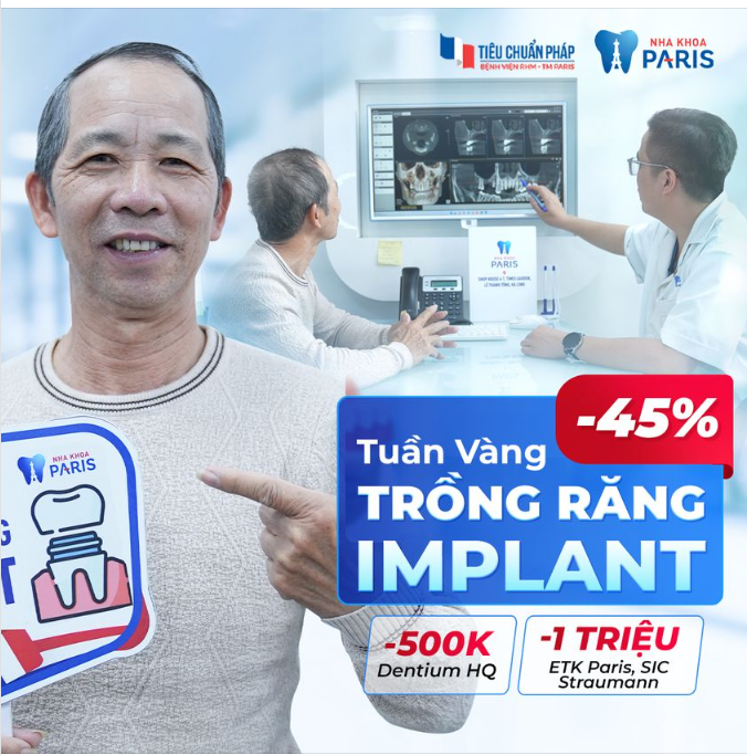 TRỒNG RĂNG IMPLANT OFF 45% - CƠ HỘI PHỤC HÌNH HÀM RĂNG KHỎE ĐẸP