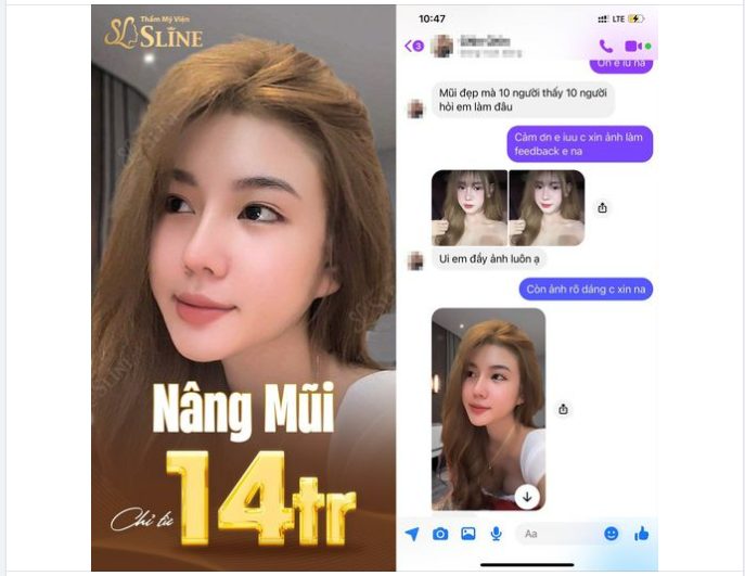 feedback:“ Mũi đẹp 10 người thấy thì 10 người đều hỏi em làm ở đâu”
