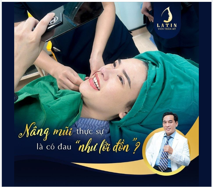 NÂNG MŨI CÓ ĐAU NHƯ LỜI ĐỒN