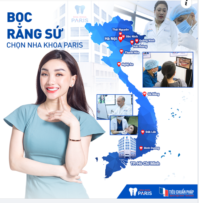 BỌC RĂNG SỨ CHUẨN BỆNH VIỆN