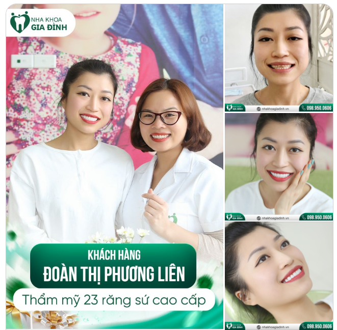 NỤ CƯỜI RẠNG RỠ ẤN TƯỢNG NGAY TỪ LẦN GẶP ĐẦU TIÊN
