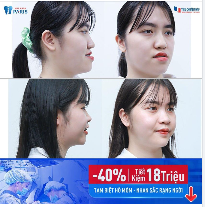 TẠM BIỆT HÔ MÓM - NHAN SẮC RẠNG NGỜI