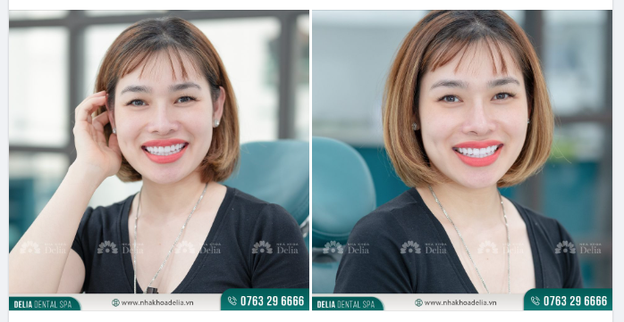 Nụ cười tỏa nắng - Trọn vẹn trong từng khung hình