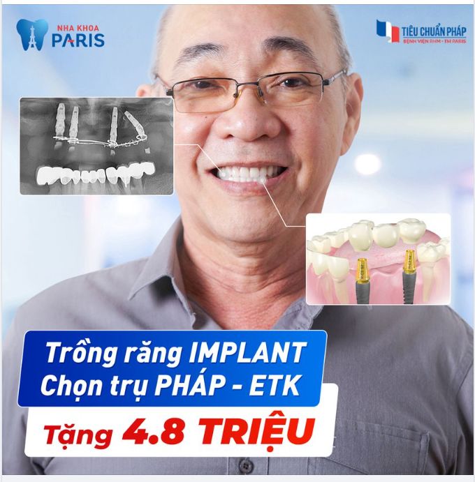TRỤ ETK PARIS ĐỘC QUYỀN CHUẨN PHÁP