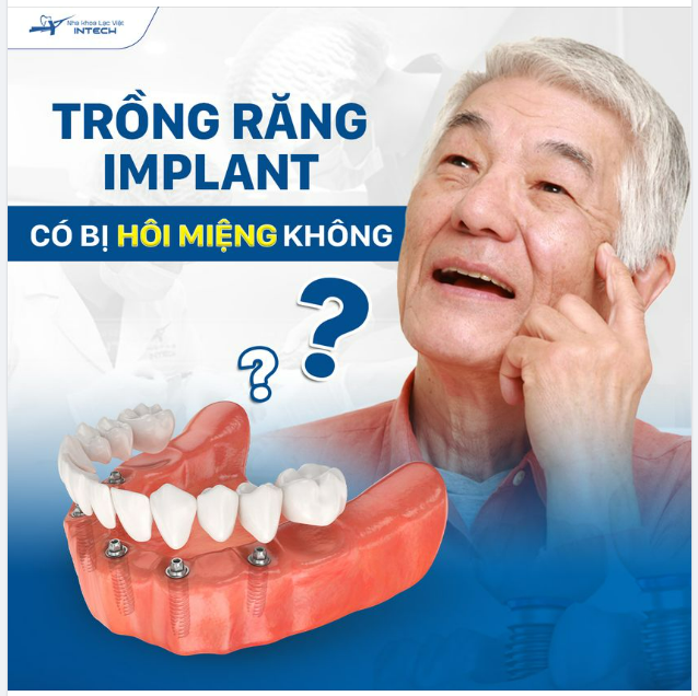 TRỒNG RĂNG IMPLANT CÓ BỊ HÔI MIỆNG KHÔNG