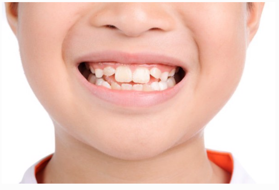 NHỮNG QUAN NIỆM SAI LẦM VỀ CHỈNH NHA