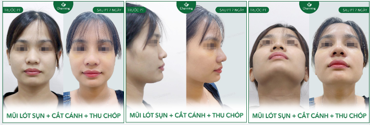 Hình ảnh trước và sau của nàng đúng là khác biệt rõ rệt luôn đúng không nào?