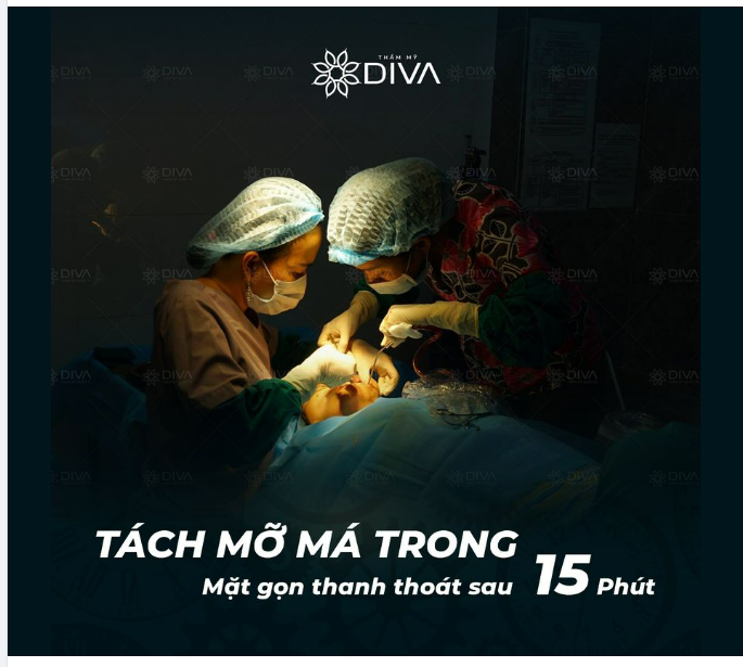TÁCH MỠ MÁ TRONG – MẶT GỌN, THANH THOÁT SAU 15 PHÚT