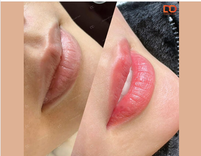 PHUN MÔI SAU BONG MÀU ĐẸP, DÁNG ĐẸP MIỄN CHÊ