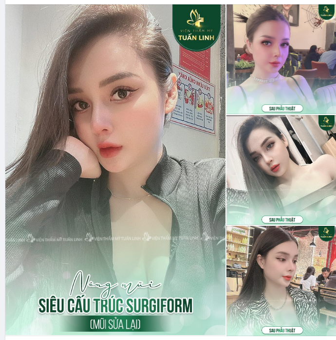 Tuy hôm nay là ngày Cá Tháng Tư nhưng mũi đẹp nhà Tuấn Linh thì là THẬT đấy ạ!!