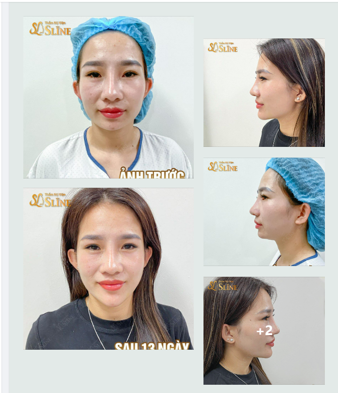 13 NGÀY - TẠM BIỆT CẰM NGẮN , LẸM.