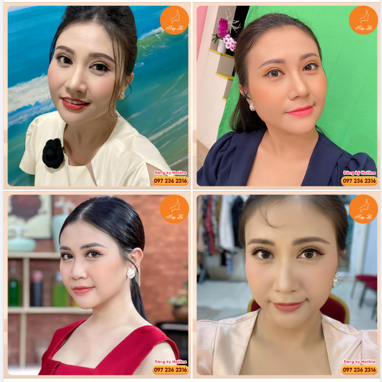 Bạn sẽ đẹp như thế nào sau khi CẮT MÍ?