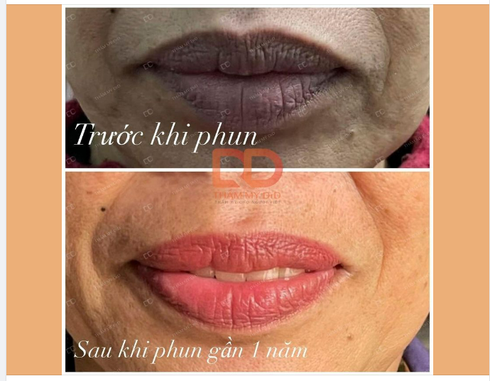 CÓ NHẤT THIẾT PHẢI XỬ LÝ THÂM MÔI TRƯỚC KHI PHUN MÀU MÔI?
