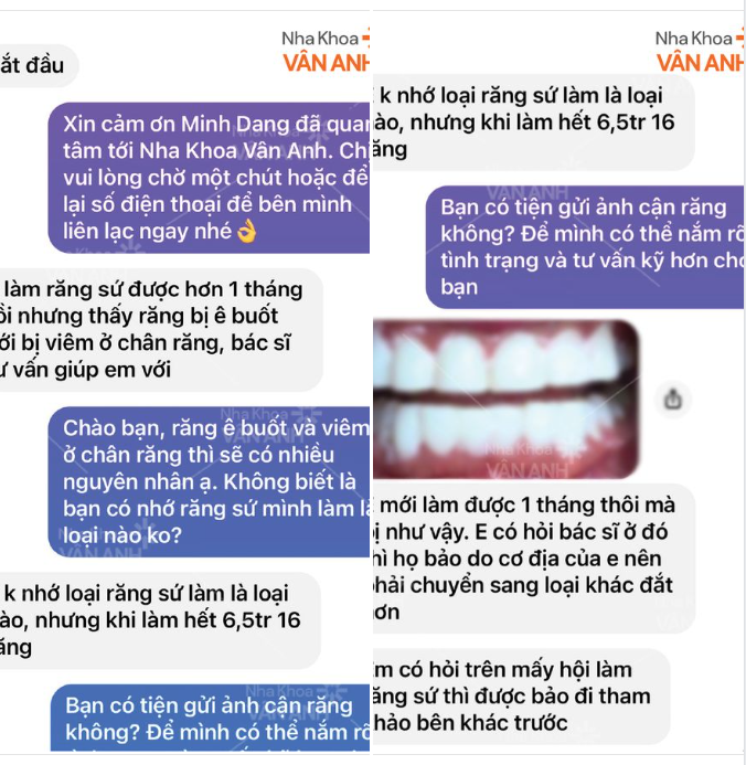 [CẢNH BÁO] RĂNG SỨ GIÁ RẺ  TƯỞNG RĂNG SỨ HÓA RA “RĂNG NHỰA”