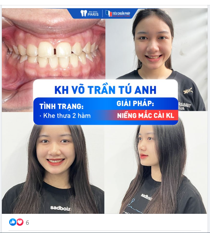 ĐÓN TUỔI THANH XUÂN VỚI NỤ CƯỜI TỰ TIN NHẤT - KH VÕ TRẦN TÚ ANH