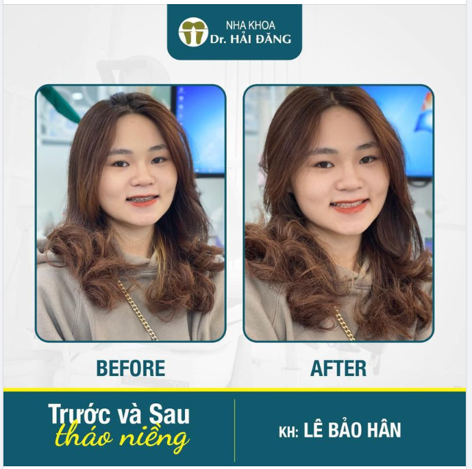 CHÚC MỪNG NGÀY THÁO NIỀNG