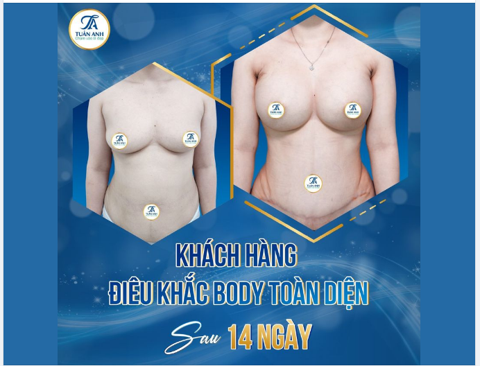 XINH ĐẸP HOÀN HẢO​​​​​​​ HẠNH PHÚC TRỌN VẸN