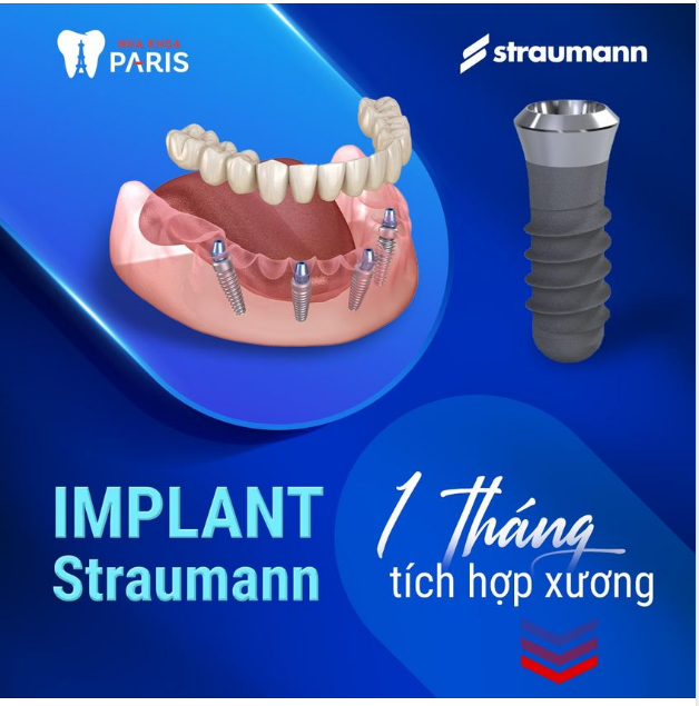 TRỤ IMPLANT STRAUMANN: ĐẮT, XẮT RA MIẾNG!