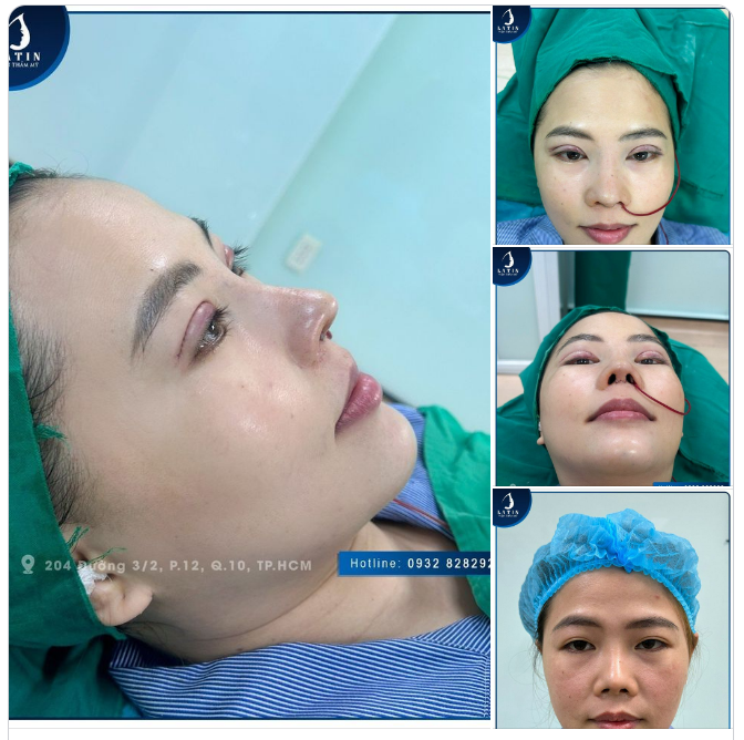 TRỞ THÀNH PHIÊN BẢN XINH ĐẸP HƠN SAU KHI SỬ DỤNG COMBO DỊCH VỤ TẠI LATIN