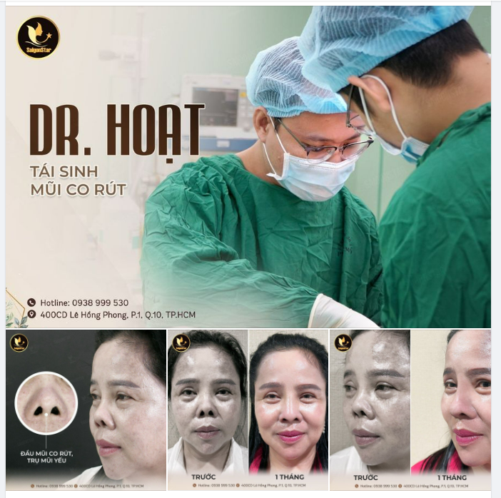 BÁC SĨ HOẠT TÁI TẠO THÀNH CÔNG CA MŨI CO RÚT, BI.ẾN DẠNG