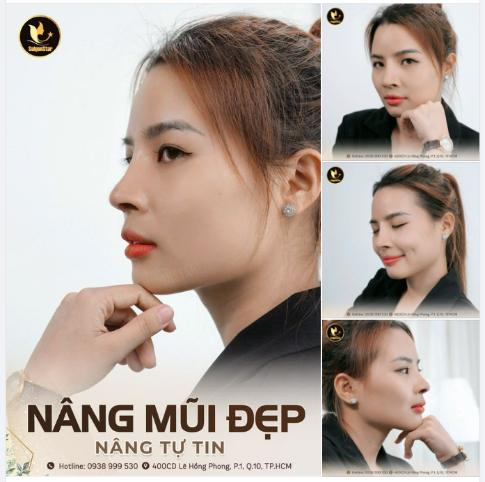 NÂNG MŨI ĐẸP – NÂNG TỰ TIN