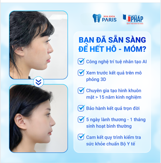 BẠN ĐÃ SẴN SÀNG ĐỂ HẾT HÔ - MÓM?