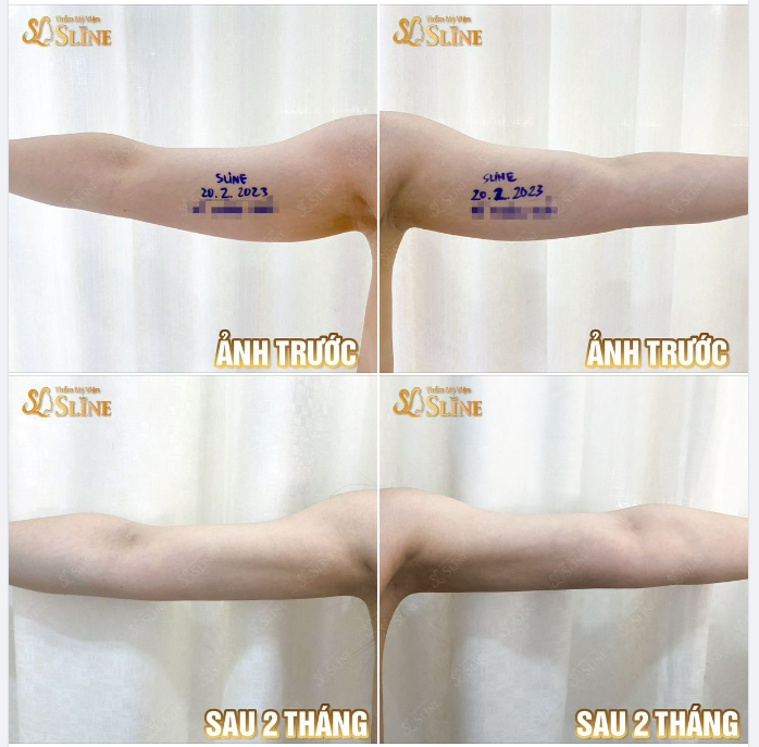 XÓA BỎ MẶC CẢM " TAY LỰC ĐIỀN"
