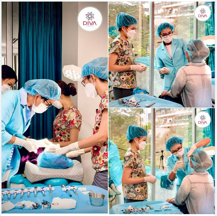 FILLER MD CODES MANG LẠI HIỆU QUẢ CAO TRONG VIỆC ĐIỀU TRỊ CHẢY XỆ KHUÔN MẶT VÌ SAO?