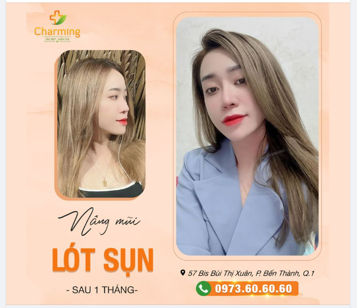 Môi em son đỏ, má hồng. Mũi em lót sụn làm lòng anh xiêu
