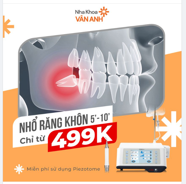 NHỔ RĂNG KHÔN “ÊM ÁI” CHƯA TỚI 10 PHÚT - CHỈ TỪ 499K