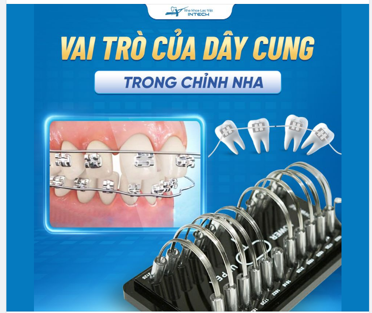 VAI TRÒ CỦA DÂY CUNG TRONG CHỈNH NHA