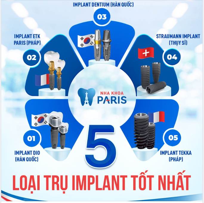 5 LOẠI TRỤ IMPLANT TỐT NHẤT HIỆN NAY TRÊN THẾ GIỚI