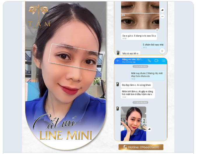 “ Ơ Thẩm Mỹ Viện Tấm có phốt à ” Em đang lo bị sẹo lồi...