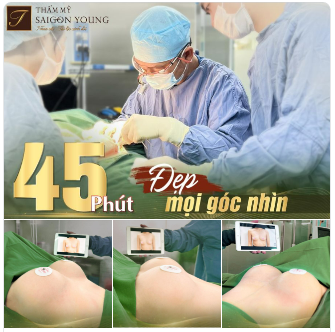 Mặc dù với tư thế đang nằm nhưng chị em có thể thấy dù góc độ nào thì vòng 1 cũng đầy đặn và căn tròn phải không ạ.