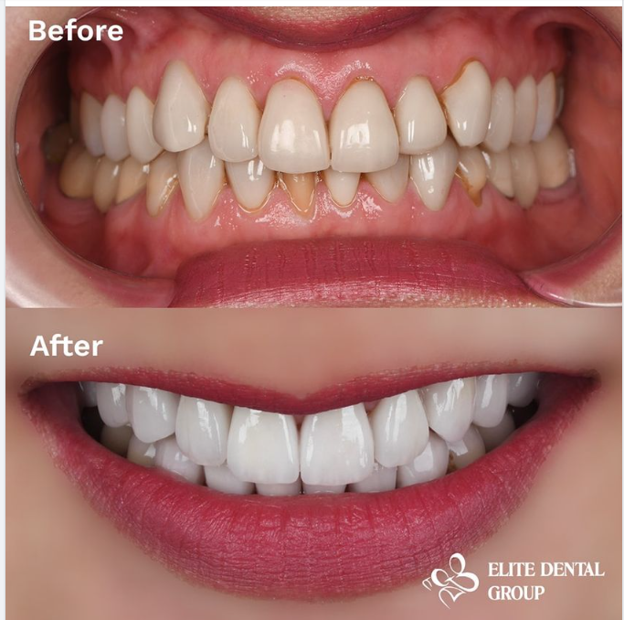 KHI GIÁM ĐỐC NHÂN SỰ ĐI LÀM RĂNG