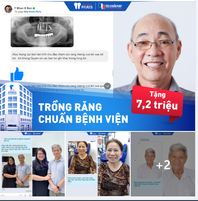 95% KH trồng răng hài lòng  20 suất OFF 45%