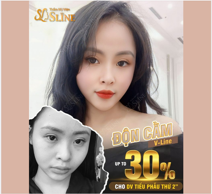“TẬU” CẰM XINH SANG - ĐẸP CHUẨN TỈ LỆ VÀNG