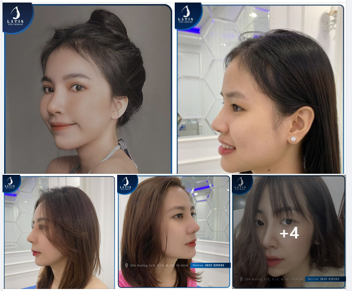 Những dáng mũi bán cấu trúc lên form SIÊU ĐẸP của khách yêu nhà Latin!