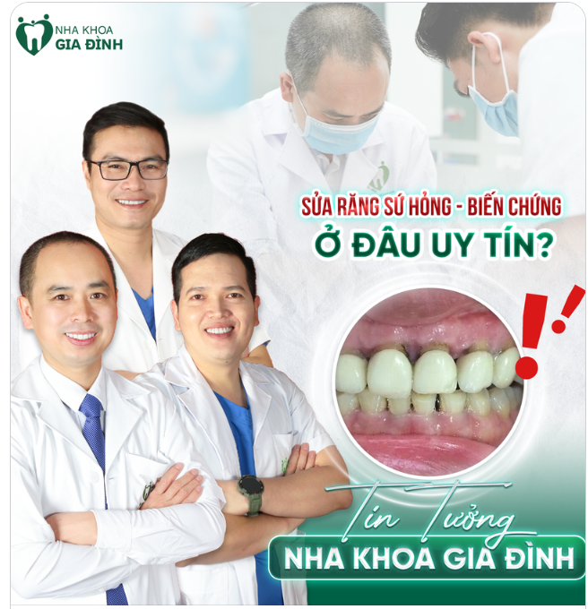 SỬA RĂNG SỨ  HỎNG  BIẾN CHỨNG Ở ĐÂU UY TÍN?