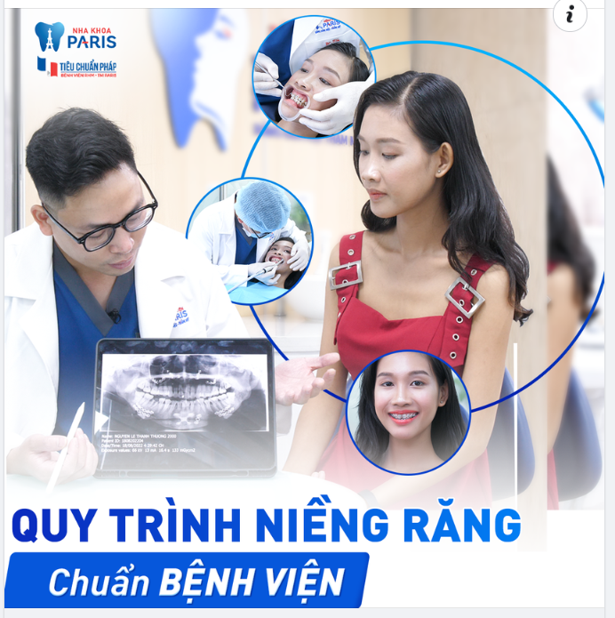 Niềng Răng Tại Nha Khoa Paris Khác Gì So Với Nha Khoa Thông Thường?
